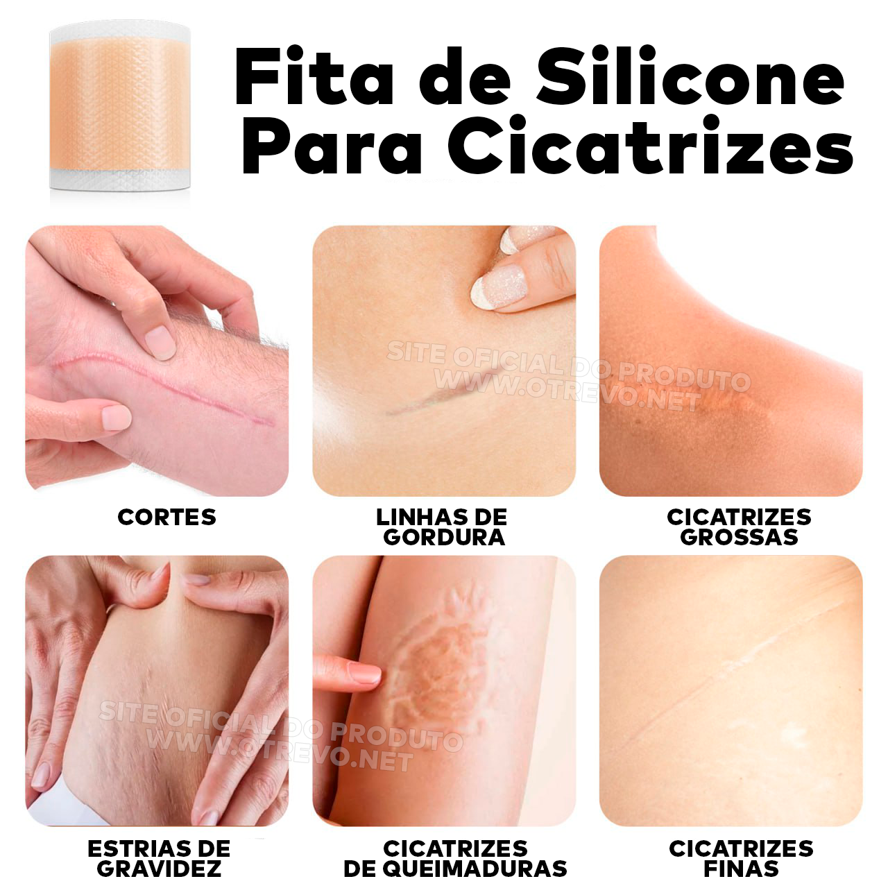 Fita de Silicone Gel Clareador Para Cicatriz (3 METROS)  - ®SilconeScar