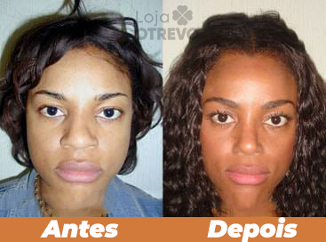 Sérum Definidor e Modelador de Nariz - DefRino®