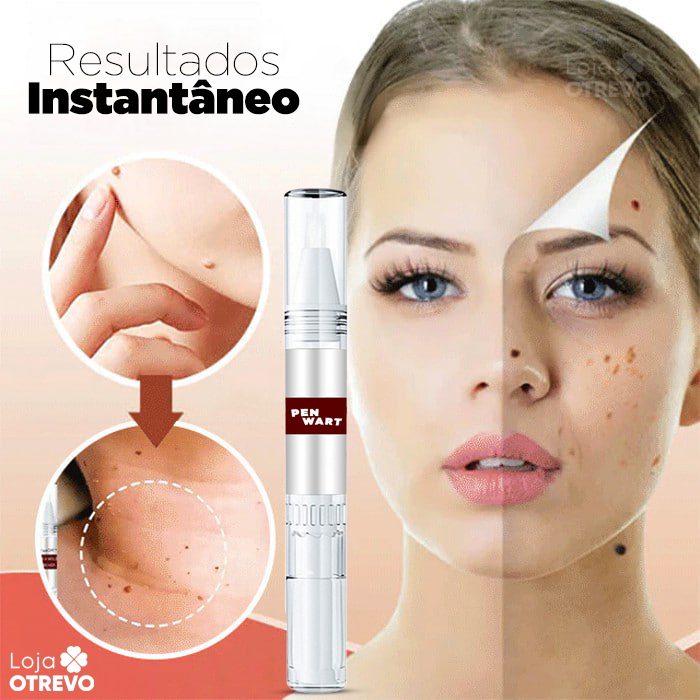PenWart® - Caneta Removedora de Verrugas e Sinais da Pele (EFEITO IMEDIATO)