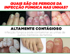 OilNail® - Sérum Reparador Rápido de Unhas (REPARAÇÃO EM 7 DIAS)