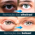 OpenEyes - Creme Reparador Rápido de Olhos (Elimina Rugas, Bolsas e Olheiras)