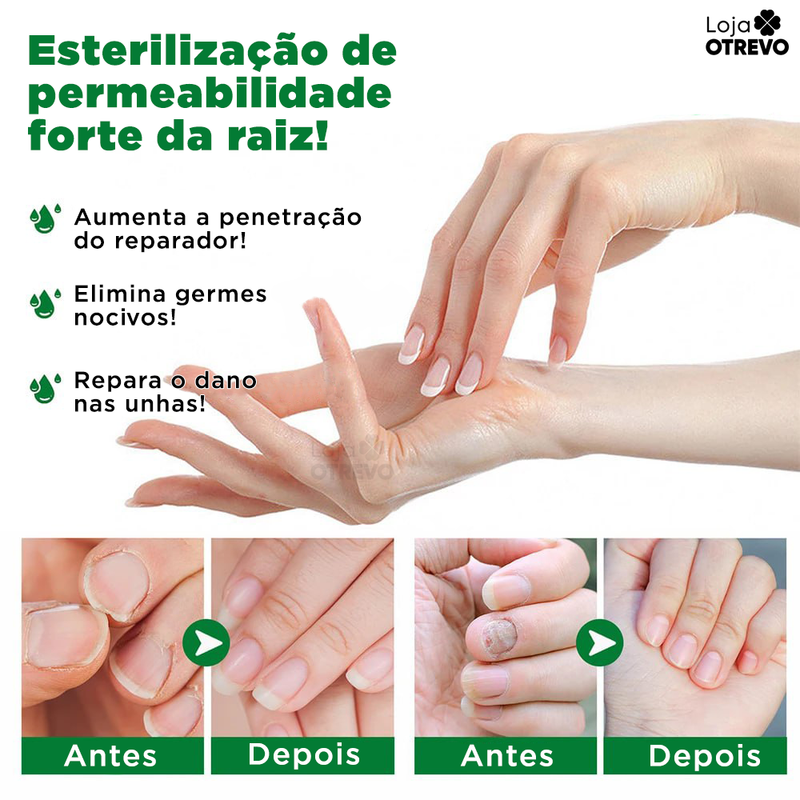 OilNail® - Sérum Reparador Rápido de Unhas (REPARAÇÃO EM 7 DIAS)