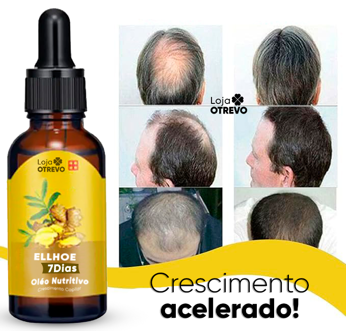 Oléo Nutritivo Para Crescimento Capilar - GrowHair ELLHOE® (CRESCIMENTO RÁPIDO EM 7 DIAS)