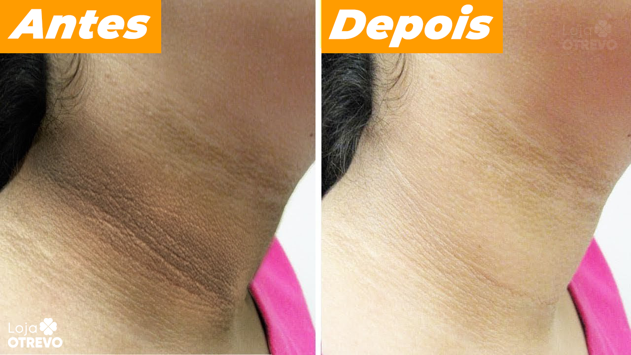 Sabonete Clareador a base de Limão e Enxofre - SoapWhite®