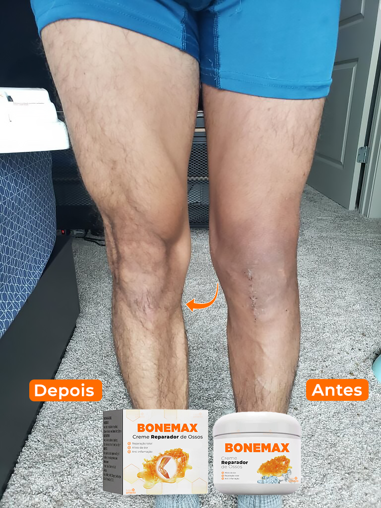 Creme Reparador de Ossos ( Desinflama, Fortalece e Restaura os Ossos) - BoneMax (HONEY BEE)®