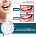  Facetas Dentárias Naturais Removíveis