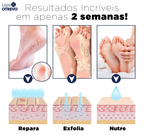 CrackCream® - Super Creme Reparador de Peles Secas e Rachaduras (Hidratação Infinita)