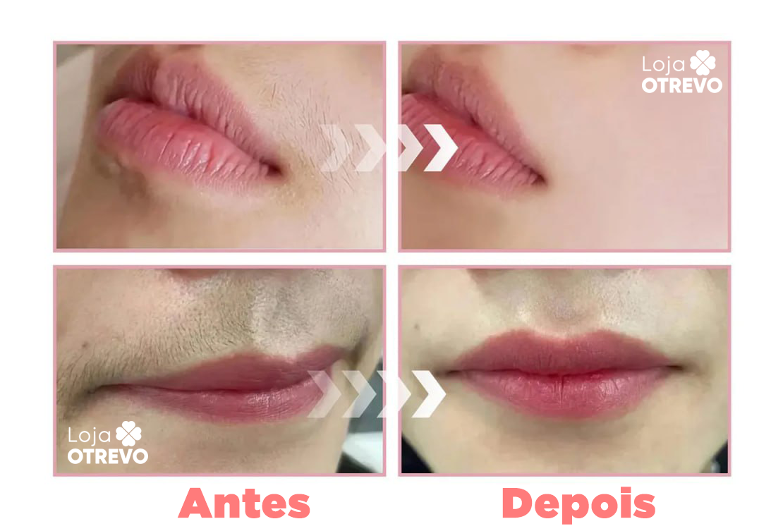 Spray Identificador de Pelos - FastDepil® (Depilação Rápida e 100% Eficiente)