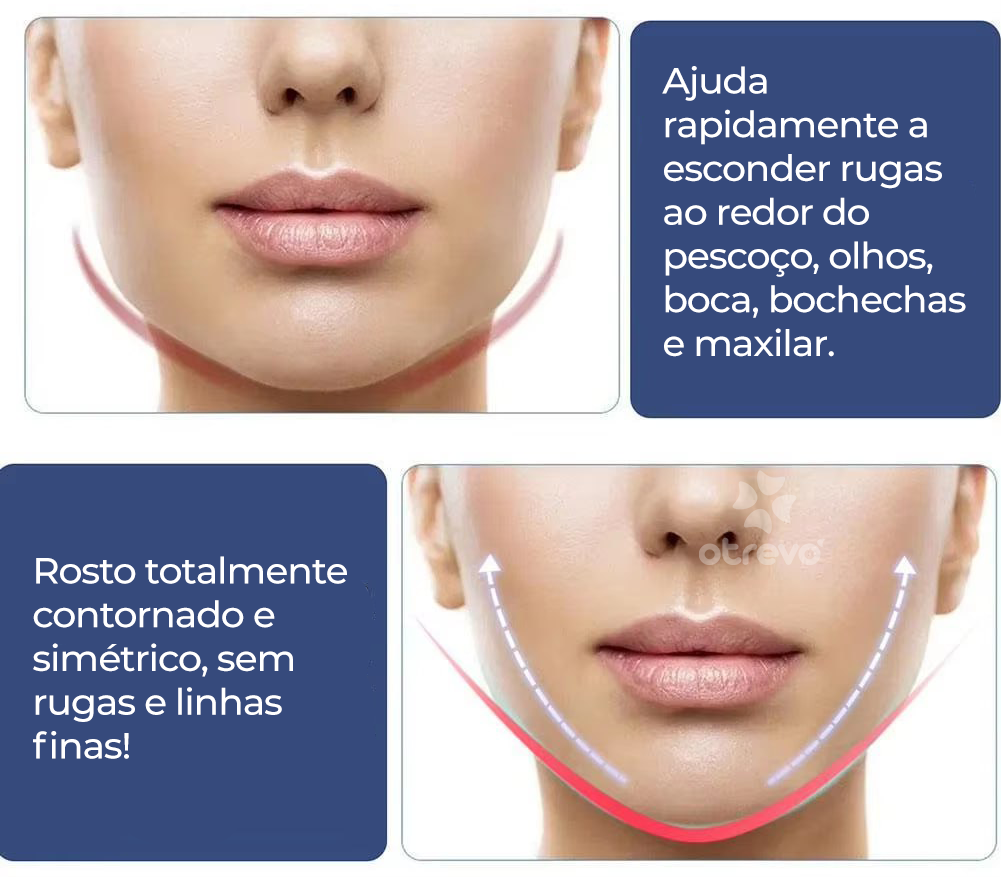 UpFace -  Esticador de Rosto e Redutor de Papada (EFEITO LIFITING INSTANTÂNEO)