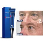 OpenEyes - Creme Reparador Rápido de Olhos (Elimina Rugas, Bolsas e Olheiras)
