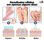 Bastão Removedor de Calos e Rachaduras (SUPER HIDRATANTE) BabyFeet®