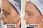 Máscara de Efeito Peeling Natural Puro Colágeno - NewFace®