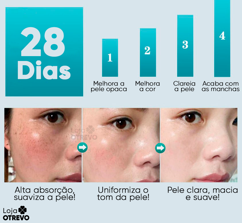 Creme Clareador de Manchas Escuras à Base de Leite - Milk Whitening® (Clareamento 100% Comprovado)