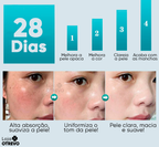 Creme Clareador de Manchas Escuras à Base de Leite - Milk Whitening® (Clareamento 100% Comprovado)