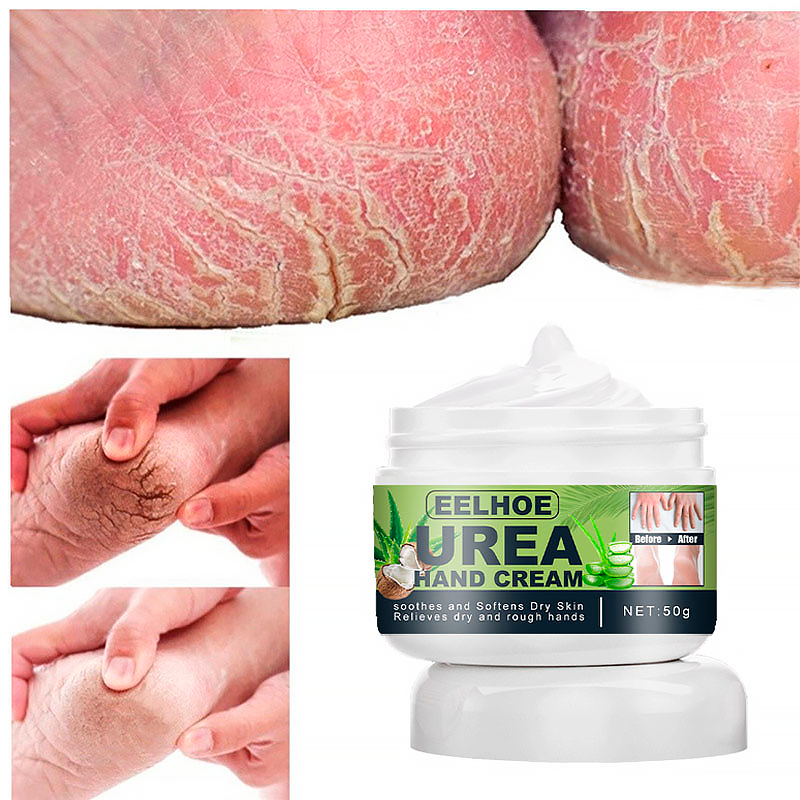 Creme Removedor de Calos e Rachaduras - ®FootCream