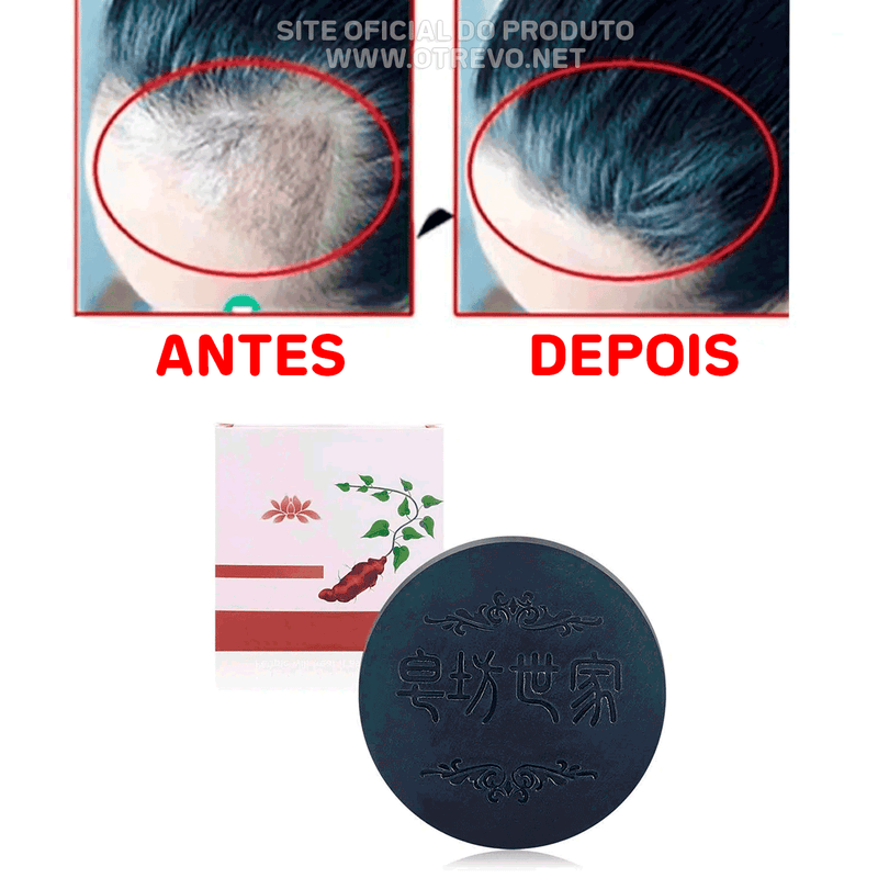 Shampoo em Barra Para Crescimento Capilar e Redutor de Fios Brancos - HairStrong® (CRESCIMENTO RÁPIDO)