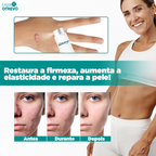 Spray Removedor Rápido de Cicatriz - ScarMax®