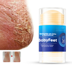 Bastão Removedor de Calos e Rachaduras (SUPER HIDRATANTE) BabyFeet®