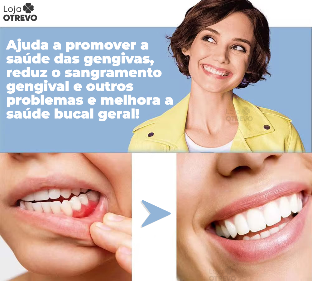 Spray Restaurador Rápido de Dentes - Própolis Oral