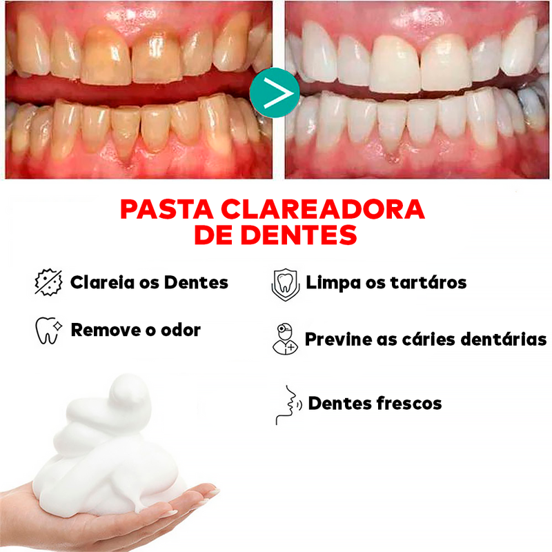 Pasta Super Clareadora Dental -  ®CristalTeeh