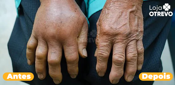 BeeVenom® - Creme Eliminador de Dor Instantâneo (Articulações e Ossos)