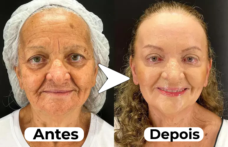 Máscara de Efeito Peeling Natural Puro Colágeno - NewFace®