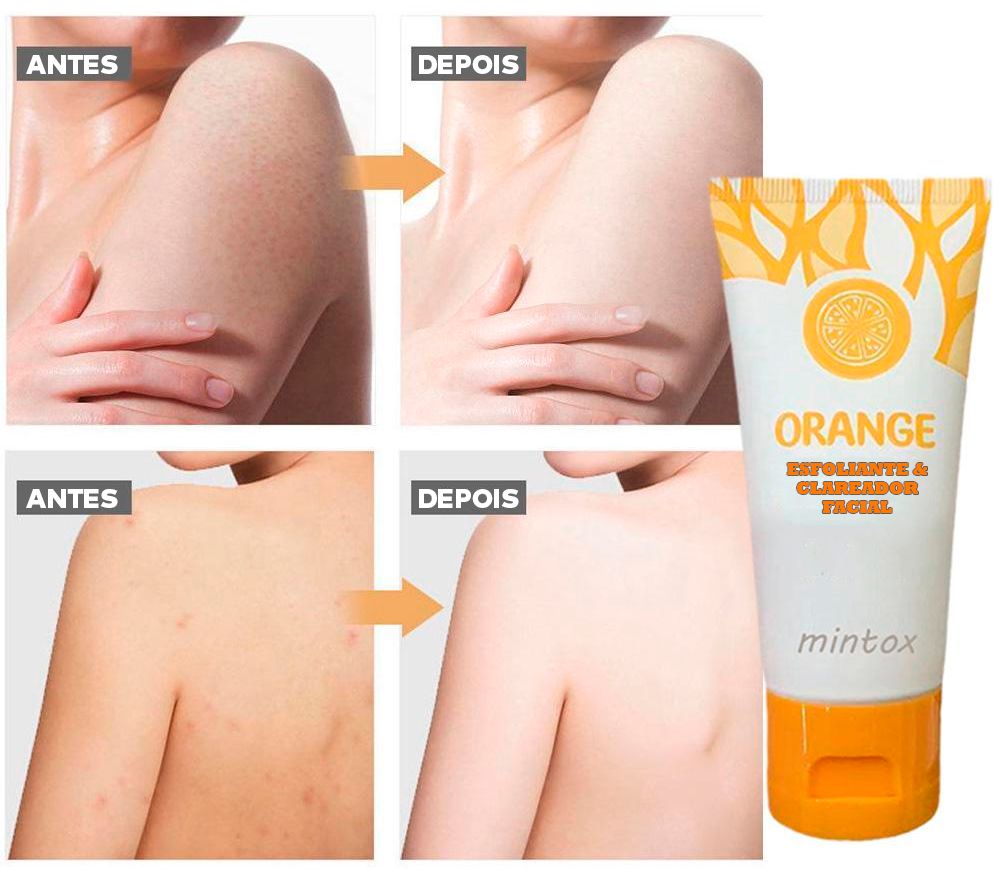 Gel Esfoliante e Clareador - ®OrangeBeauty (100% de Clareamento e Hidratação da Pele)
