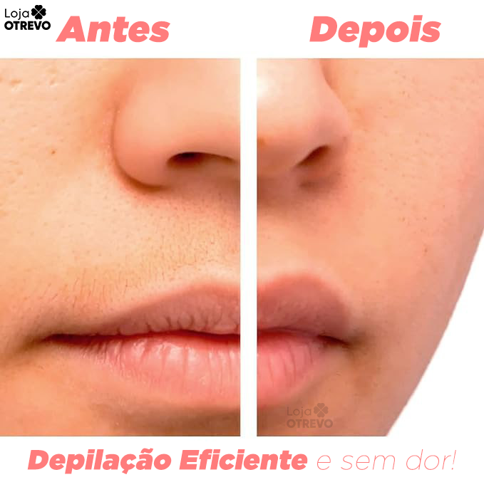 Depilador Elétrico Indolor (Portátil)  - SmartDepil®