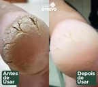 DermaShield - Spray Restaurador Rápido de Pés
