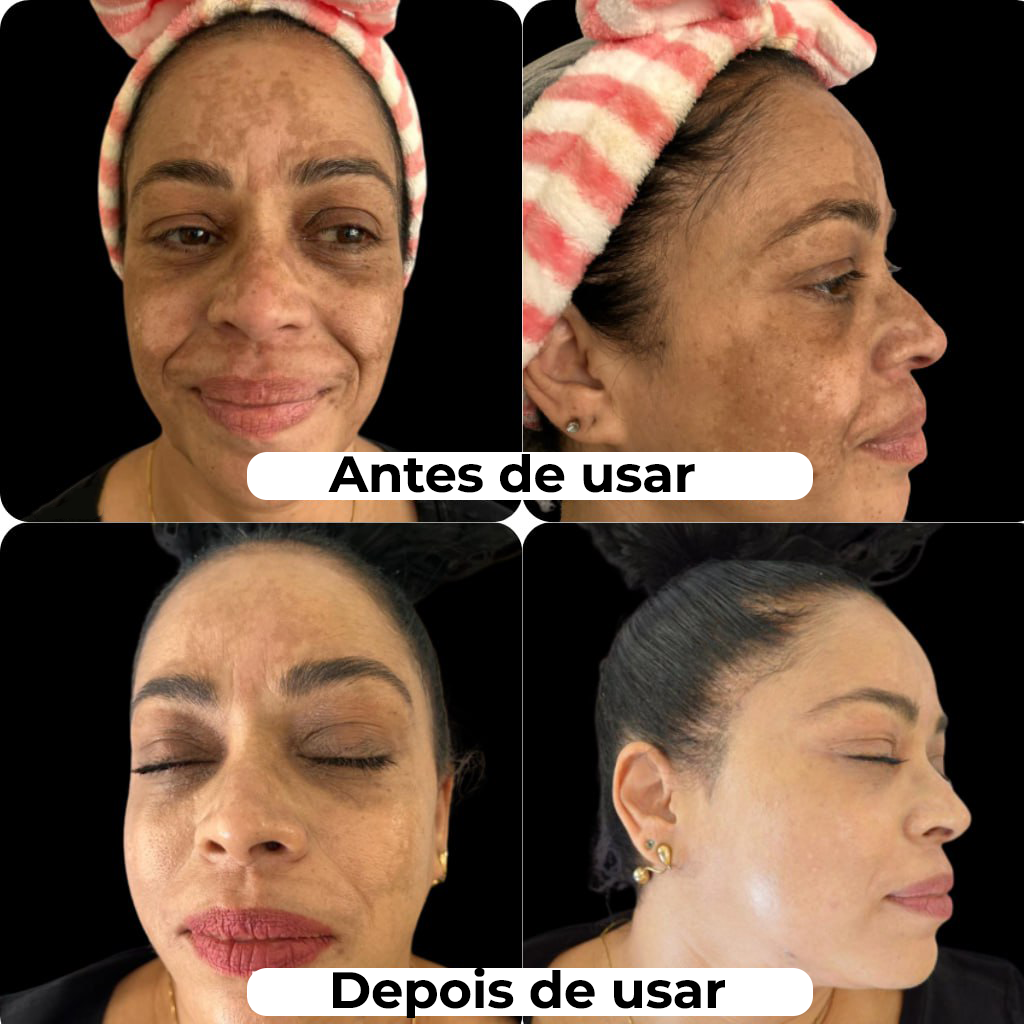 Máscara de Efeito Peeling Natural Puro Colágeno - NewFace®