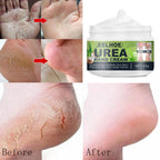 Creme Removedor de Calos e Rachaduras - ®FootCream