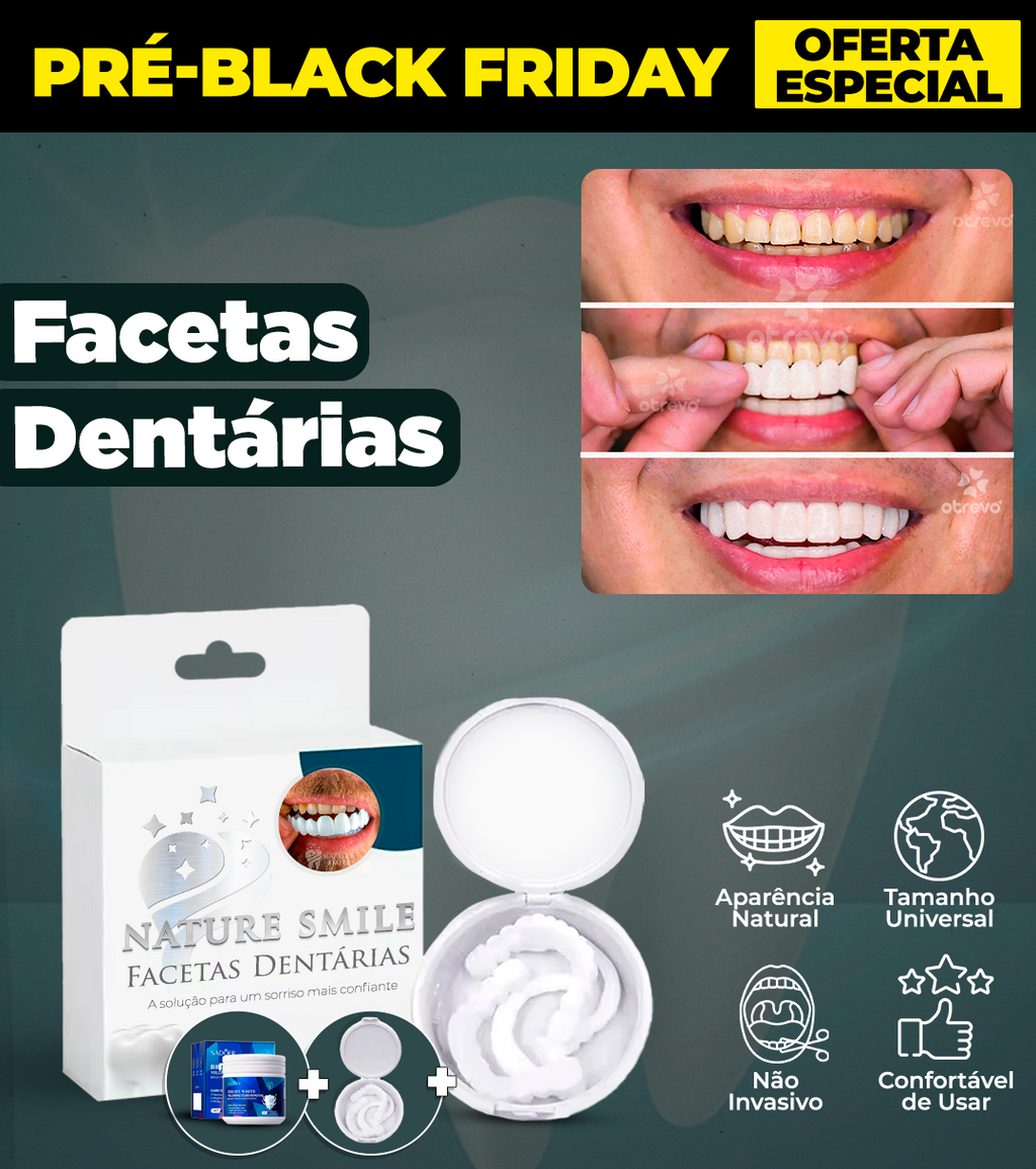 Nature Smile® - Facetas Dentárias Removíveis (COMPRE 1 PAR E LEVE OUTRO)