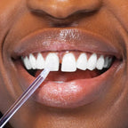 Gloss Clareador Dental Instântaneo - SMILEKIT®