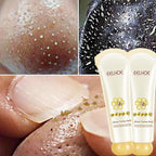 Mascara Removedora de Cravos a Base de Mel - ®HoneySkin (REMOVE OS POROS E REJUVESNECE O ROSTO)