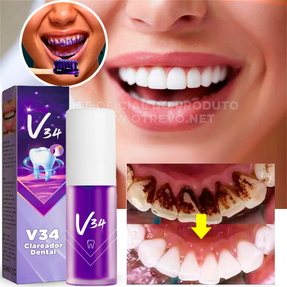 Clareador Dental - ®V34 (Clareamento instantâneo)