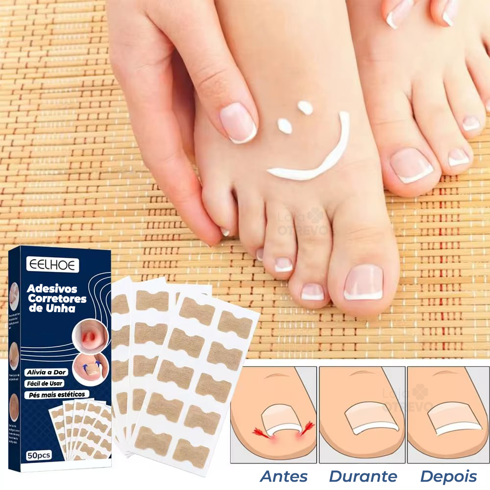 Adesivos Corretores de Unha - PatchNail® (REPARAÇÃO EM 7 DIAS)