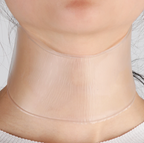 Adesivos de Silicone Antiestrias e Antirrugas Reutilizáveis - ®Youngirl (PELE 100% MAIS JOVEM)