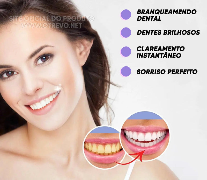 Gloss Clareador Dental Instântaneo - SMILEKIT®