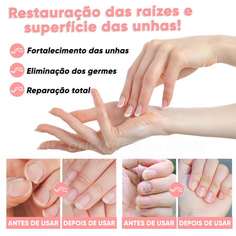 FungiPró RtopR® 3 em 1 (Reparador, Restaurador e Fortalecedor de Unhas)