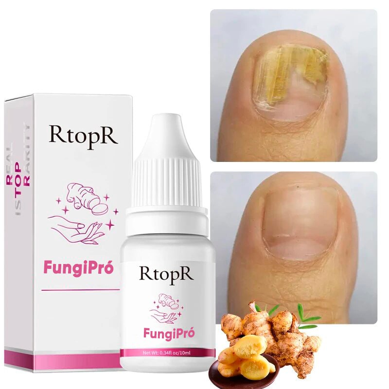 FungiPró RtopR® 3 em 1 (Reparador, Restaurador e Fortalecedor de Unhas)