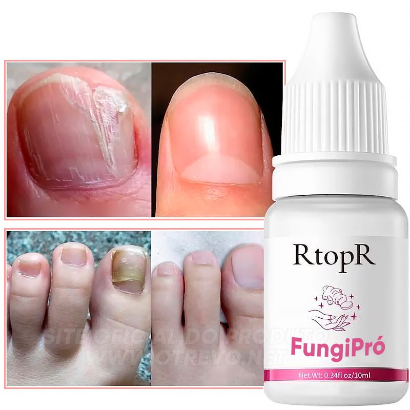 FungiPró RtopR® 3 em 1 (Reparador, Restaurador e Fortalecedor de Unhas)