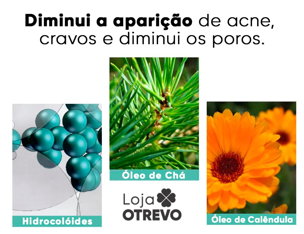 Adesivos Hidrocoloide Secadores e Removedores de Espinhas - AcneControl®