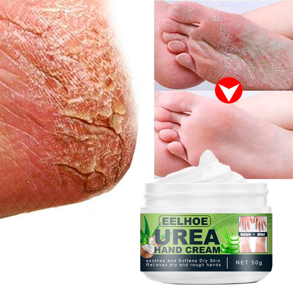 Creme Removedor de Calos e Rachaduras - ®FootCream