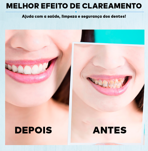 5D WHITE® - Fita Clareadora Dental (Clareamento instantâneo)