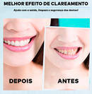 5D WHITE® - Fita Clareadora Dental (Clareamento instantâneo)