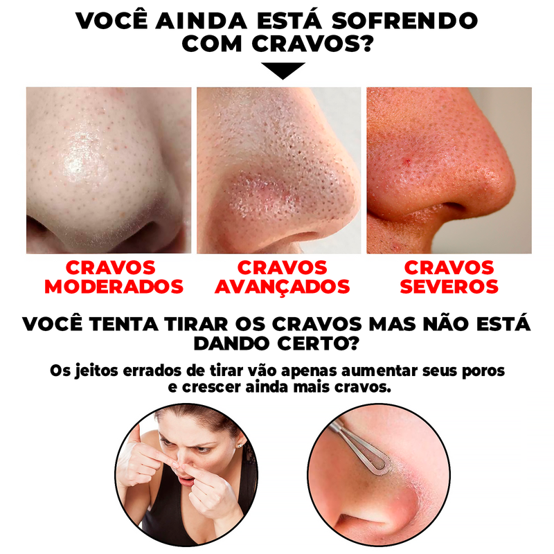 Removedor de Cravos a Base de Bambu - SkinBamboo® (REMOÇÃO 100% DOS CRAVOS)