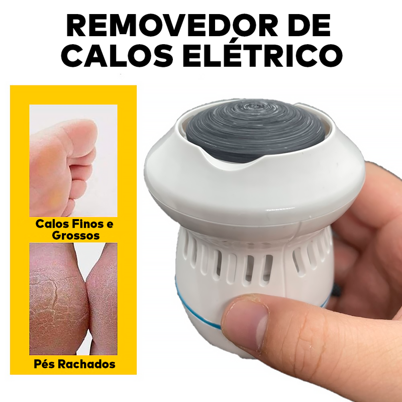 Esfoliador Removedor Elétrico para Calos e Rachaduras - ®Max Pedicure