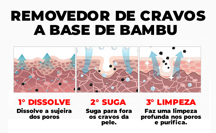 Removedor de Cravos a Base de Bambu - SkinBamboo® (REMOÇÃO 100% DOS CRAVOS)