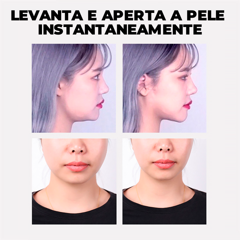 UpFace -  Esticador de Rosto e Redutor de Papada (EFEITO LIFITING INSTANTÂNEO)