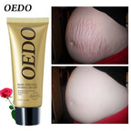 Creme Para Remoção de Estrias - ®OEDO BEAUTY